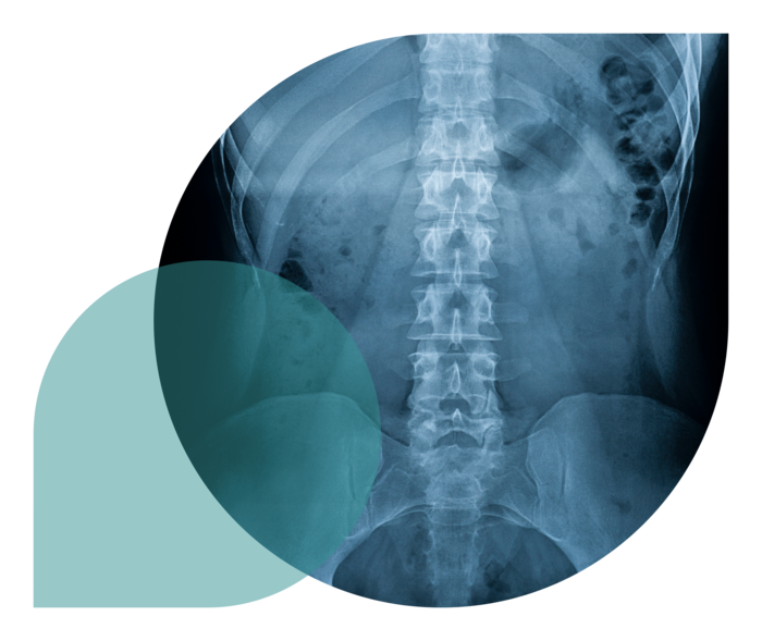 Röntgenbild einer Wirbelsäule.