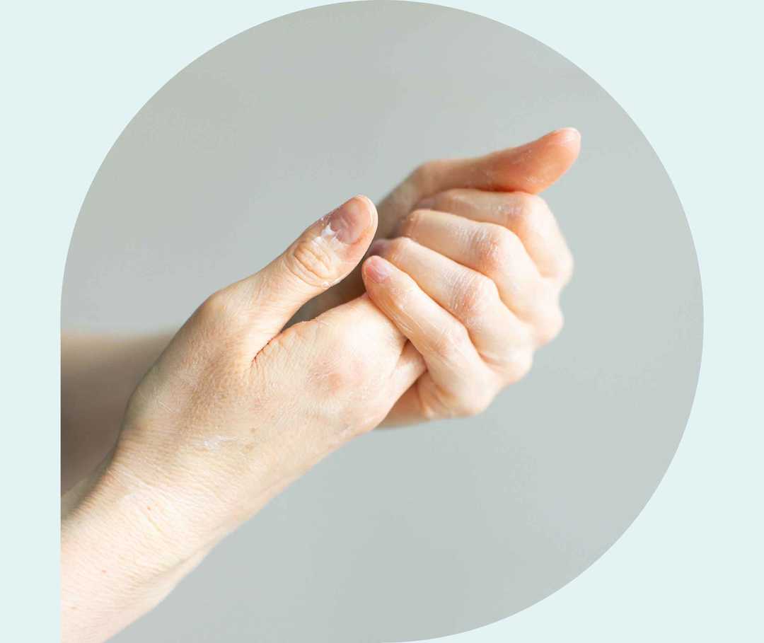 Ratgeber Rheuma: Eine Frau reibt sich die Hände Ratgeber Rheuma: Eine Frau reibt sich die Hände