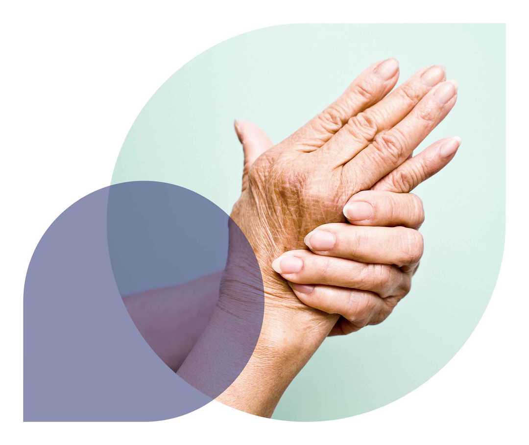 Ratgeber Rheuma: Eine Frau reibt sich die schmerzenden Hände