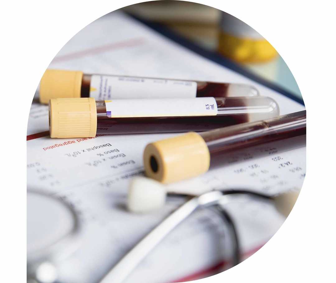 Ratgeber Rheuma: Auf einem Tablet liegen Blutabnahmeröhrchen und ein Stethoskop