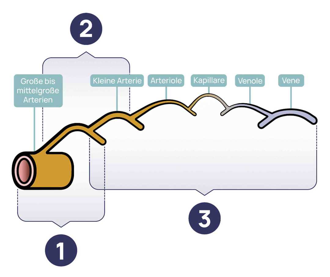 Ratgeber Rheuma: Die Grafik zeigt die verschiedenen Vaskulitiden-Arten