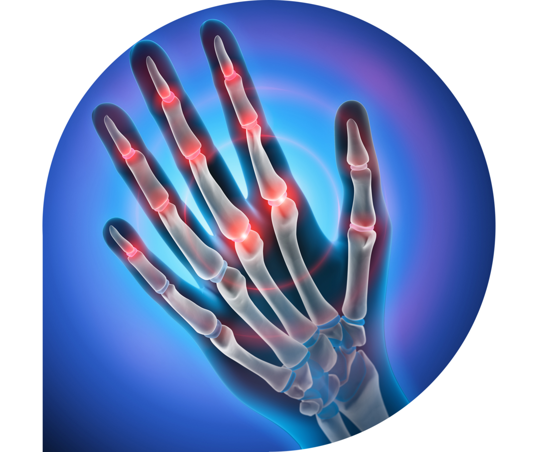 Eine Röntgenaufnahme einer Hand