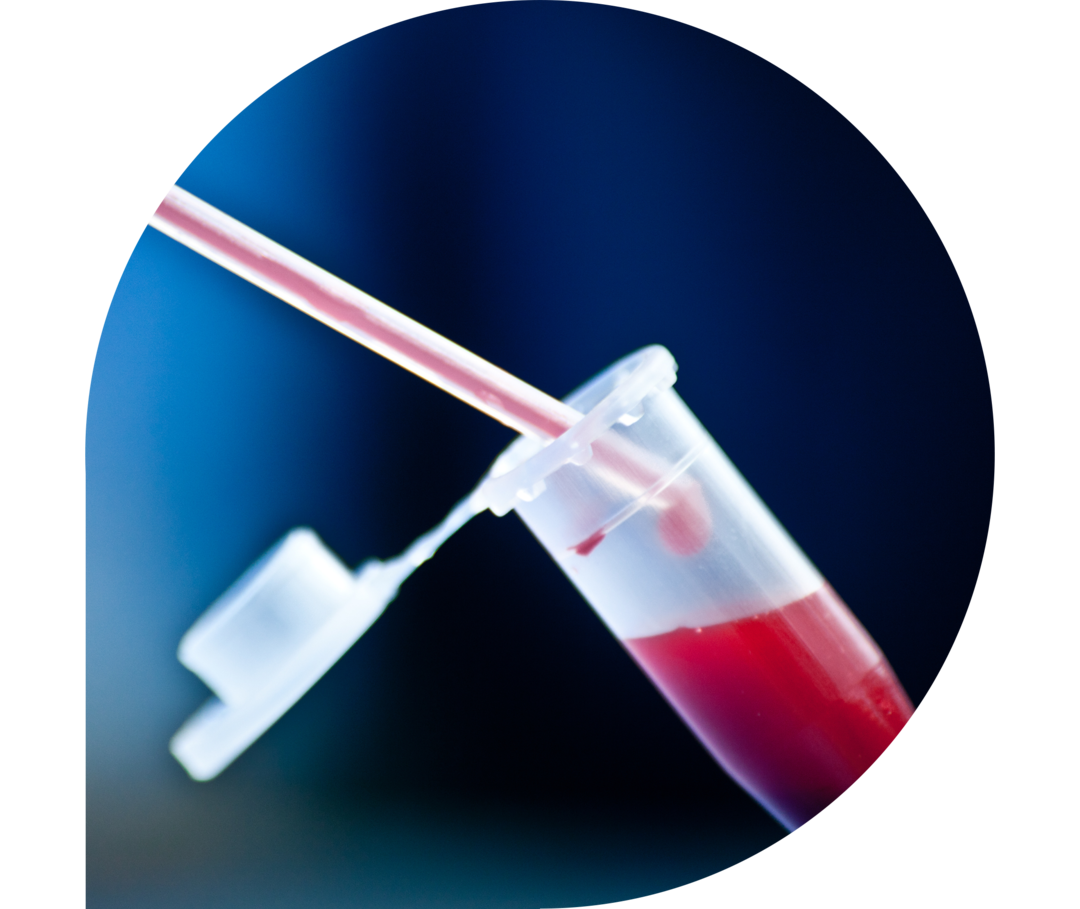 Ratgeber Rheuma: Eine Flüssigkeit wird Kunststoffröhrchen gegeben Ratgeber Rheuma: Eine Flüssigkeit wird Kunststoffröhrchen gegeben