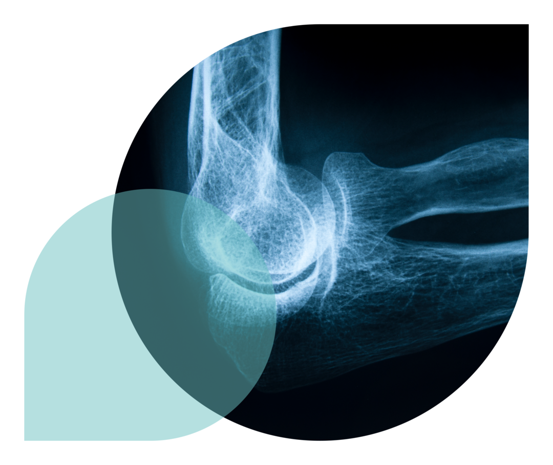 Ein Teaserbild der Diagnose-Unterseite